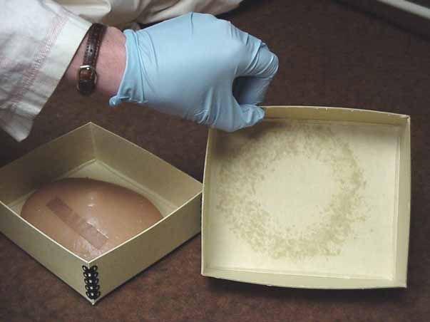 Photo: Residue from a silicon breast implant stains a storage box at the National Museum of American History. (Photo courtesy National Museum of American History).