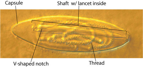 Microscopic view of an undischarged nematocyst from Tamoya ohboya (Nematocyst prepared, photographed, and labeled by Tara Lynn)
