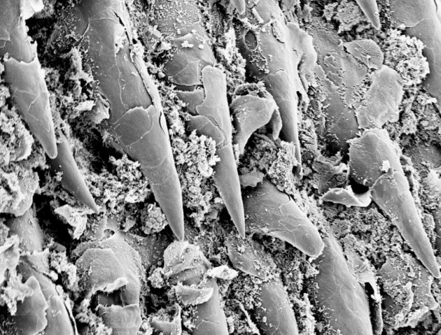 penisul la microscop