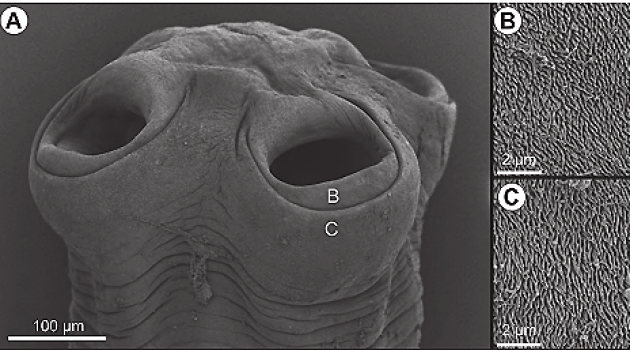 These scanning electron microscope images show the anterior ends or scolexes of the tapeworms "Anonchotaenia brasiliensis," top, and "Anonchotaenia macrocephala," two species recently re-described by Phillips and colleagues. The worms use these " suckers" to anchor themselves to their host's intestinal wall. Images at right show extreme close-up of the sucker surfaces.