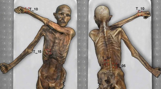 This graphic shows the general location of each of the 61 tattoos on the Iceman's body. (Photograph © South Tyrol Museum of Archeology/EURAC/Samadelli/Staschitz.)