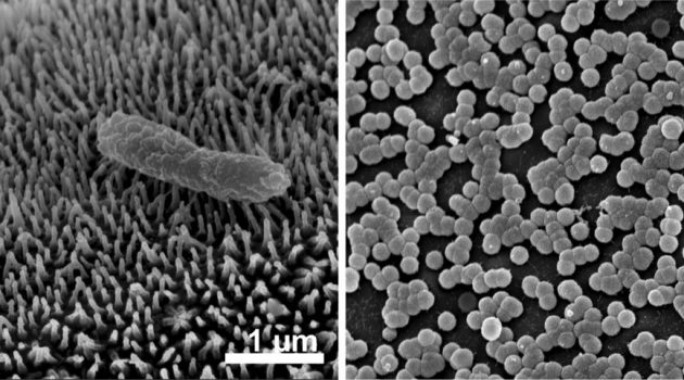 Photos from a scanning electron microscope show the brush-like array of light-absorbing structures on the leg of a midwater crustacean called Cystisoma at left, and the tiny spheres that perform the same function on the body of Phronima, another midwater crustacean. The spheres may be a colony of bacteria specific to Phronima. (Images by Laura Bagge, Duke University)